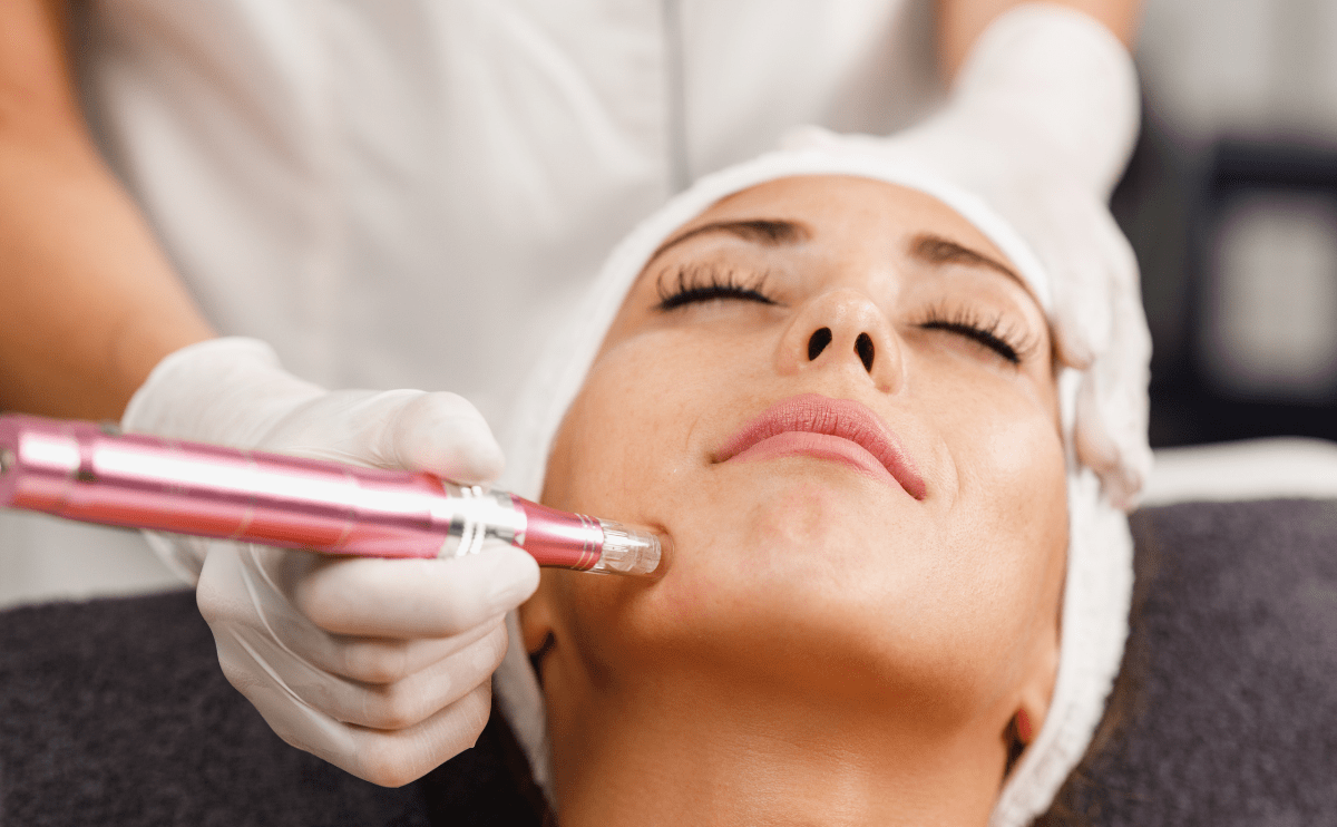 "master class dermapen en laca"